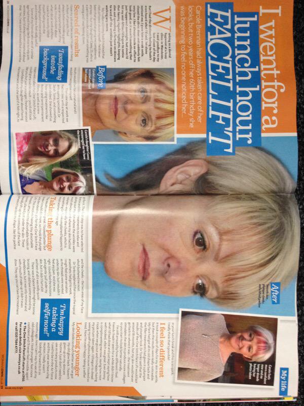 DrSarahTonks's tweet photo. Front page news @WomansOwn today with @SilhouetteSoft #thread lift #PuppetFacelift !! http://t.co/rk2FYiylpE