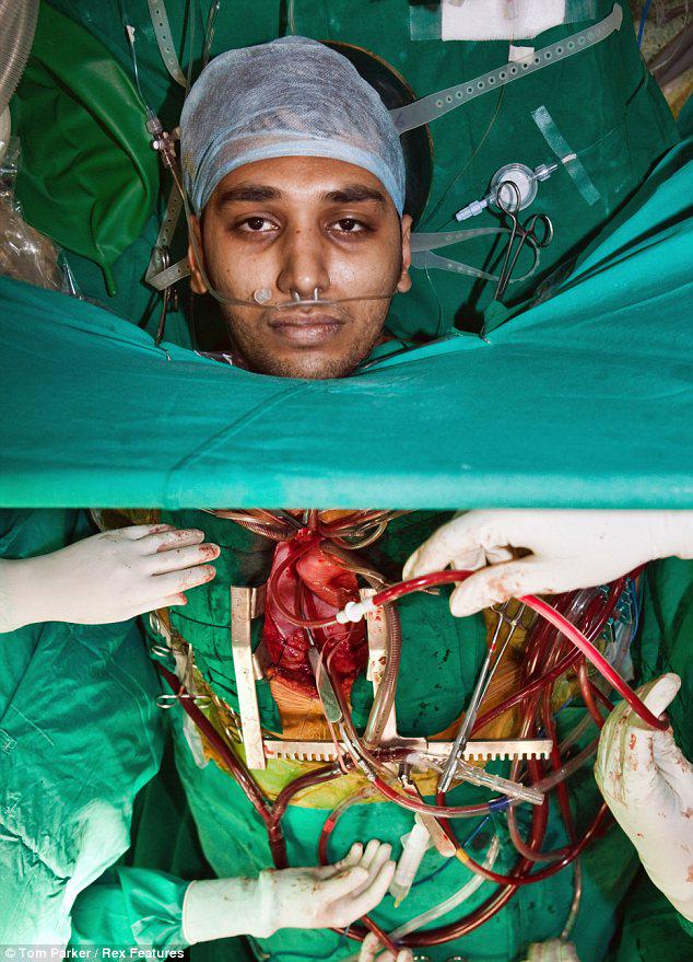 eSATURNUS's tweet photo. Surgery while being awake http://t.co/dGIcJ566VC #surgery #heartsurgery @DailyMail http://t.co/CrvgMnDyRF