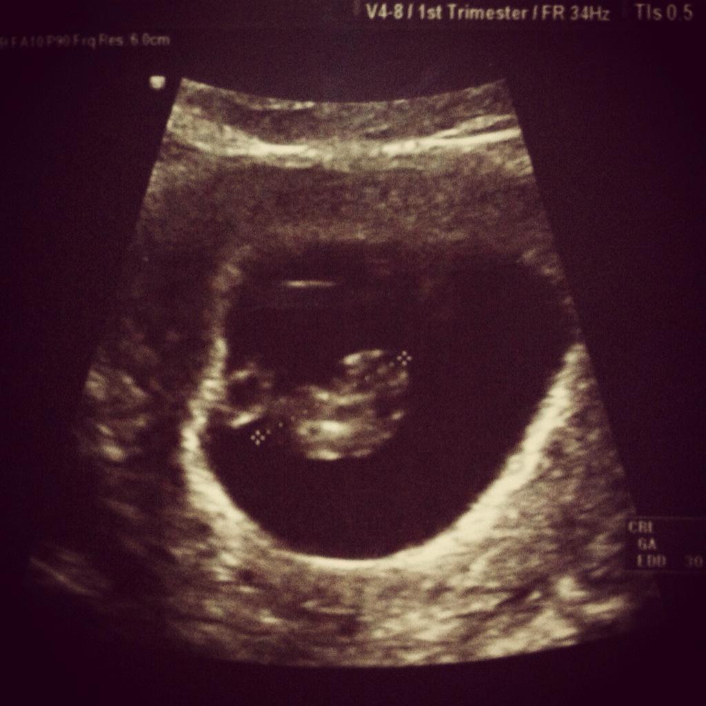 pwierahmawati's tweet photo. heiii baby👶👶👶 sehat terus yaaa sayanggg d perut ibu😘😘😘 http://t.co/FWJa5XLT0p