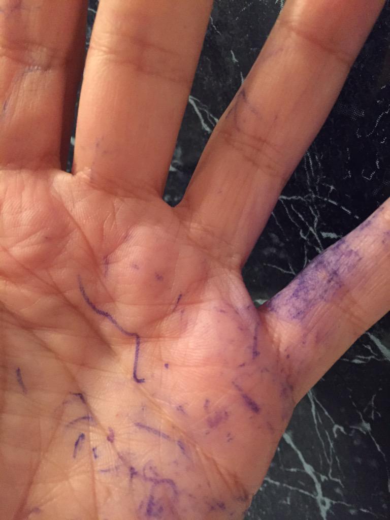 Mi mano despues de 8 horas seguidas  de firma!!! 😃😃😃