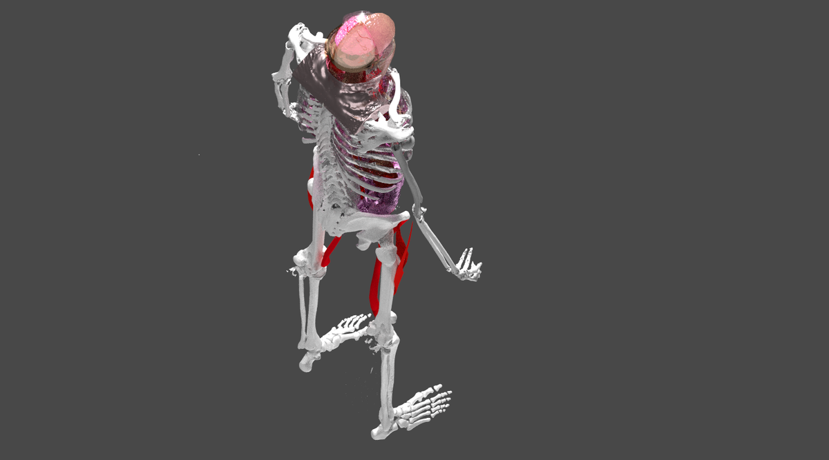 kickstartbuzz's tweet photo. #NationOfMakers|Know a #maker #patron? Help @printhuman add all organs @NIH3Dprint #3DPH at https://t.co/UpaSiN3gaU http://t.co/88JFaLMOht