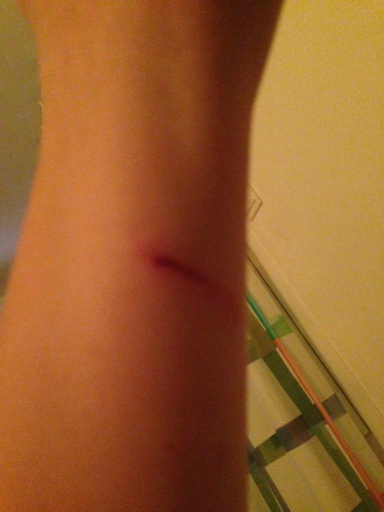 sdinnis's tweet image. Getting stuck in #notworkshy #injury