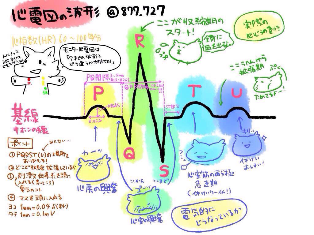 看護師のかげさん イラスト看護帖書籍化 A Twitter 不整脈復習 モニター心電図のrecallを見てパッとhr この波形はaf Psvt と読むところから始まって このずっとafの人と サイナスとafを繰り返す Pafとか 人とどっちがリスクのある状態 と考えるとさらに