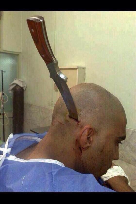 ComedyPosts's tweet photo. school nurses be like come back if its still hurting after lunch http://t.co/zTMrtxAOcs