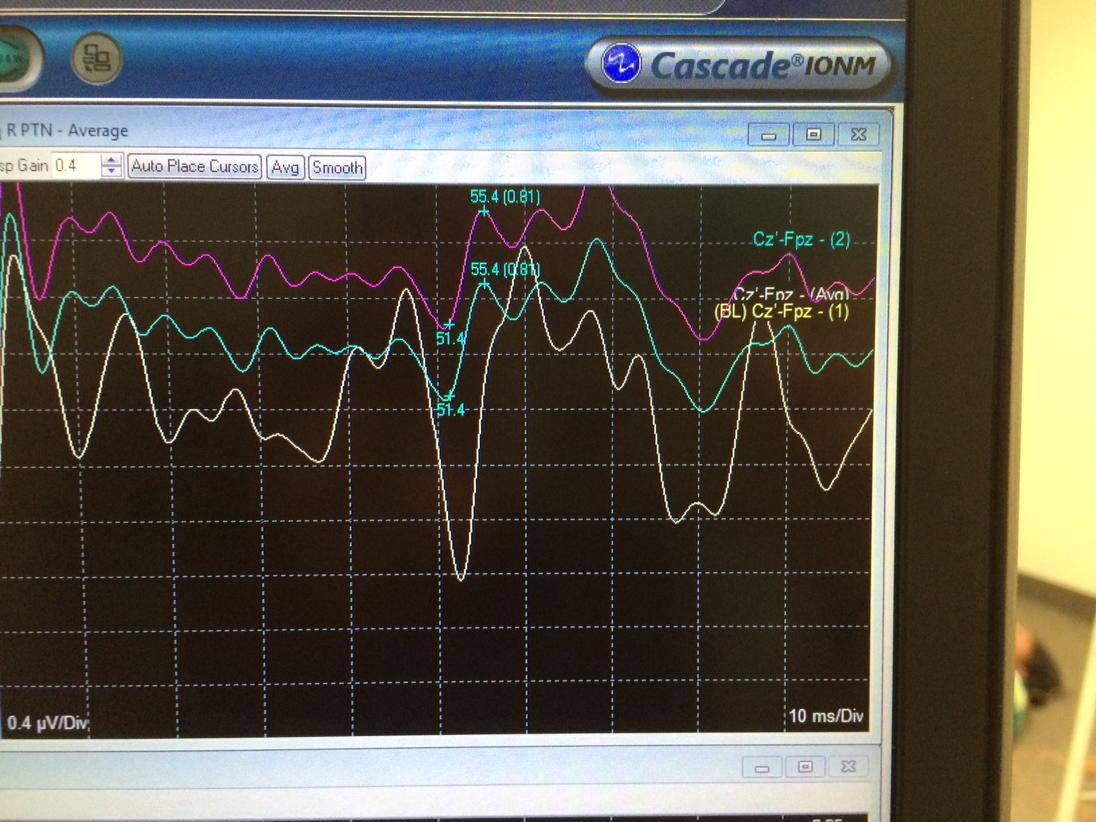 GINT_Dallas's tweet photo. Testing out leads that were generously supplied by @Rhythmlink 
Thank you! http://t.co/rp78BMjZBr