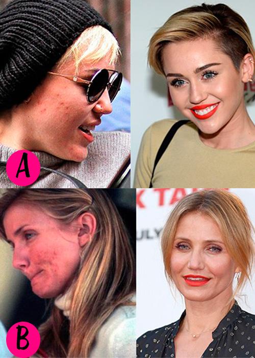 cosmopolitanmx's tweet photo. #COSMOPregunta ¿Cuál de estas famosas tuvo un cambio radical después de sufrir acné? http://t.co/IhcK26PY5U http://t.co/rpo5swrjdG