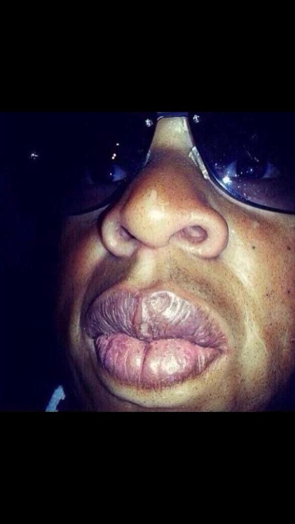 When you do the Kylie Jenner challenge.