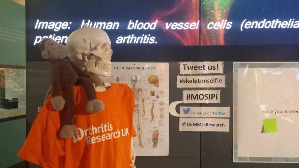 CAPSIE_CAPS's tweet photo. my new friend Arthur #skeletonselfie #MOSIPi @UoMMskResearch http://t.co/yuodVm8JdT