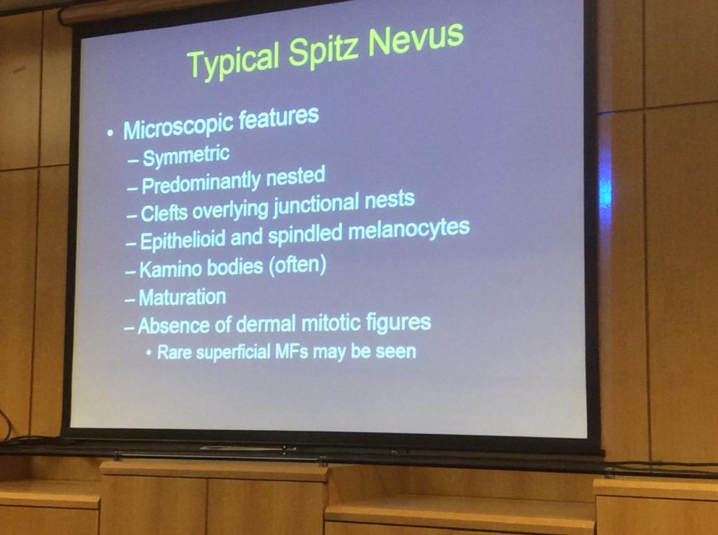 HassellLewis's tweet photo. #Spitz #Nevi usually in younger <20yo people, extremities, often rapid growth Dr. Billings #OSAP15 #pathboards http://t.co/usYqbBAHU4