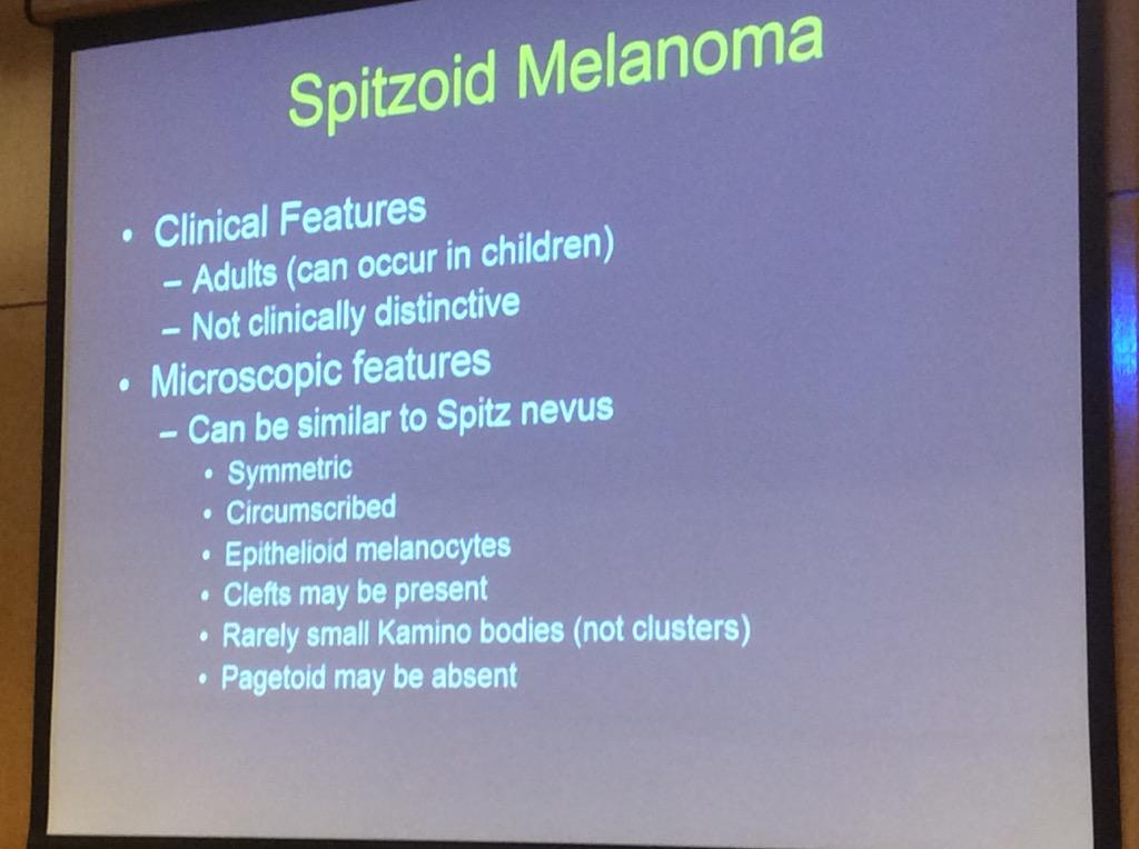 HassellLewis's tweet photo. Spitzoid #melanoma Challenging DDx, get help! look for prominent pagetoid spread #OSAP15 http://t.co/bmhCuqKUJH