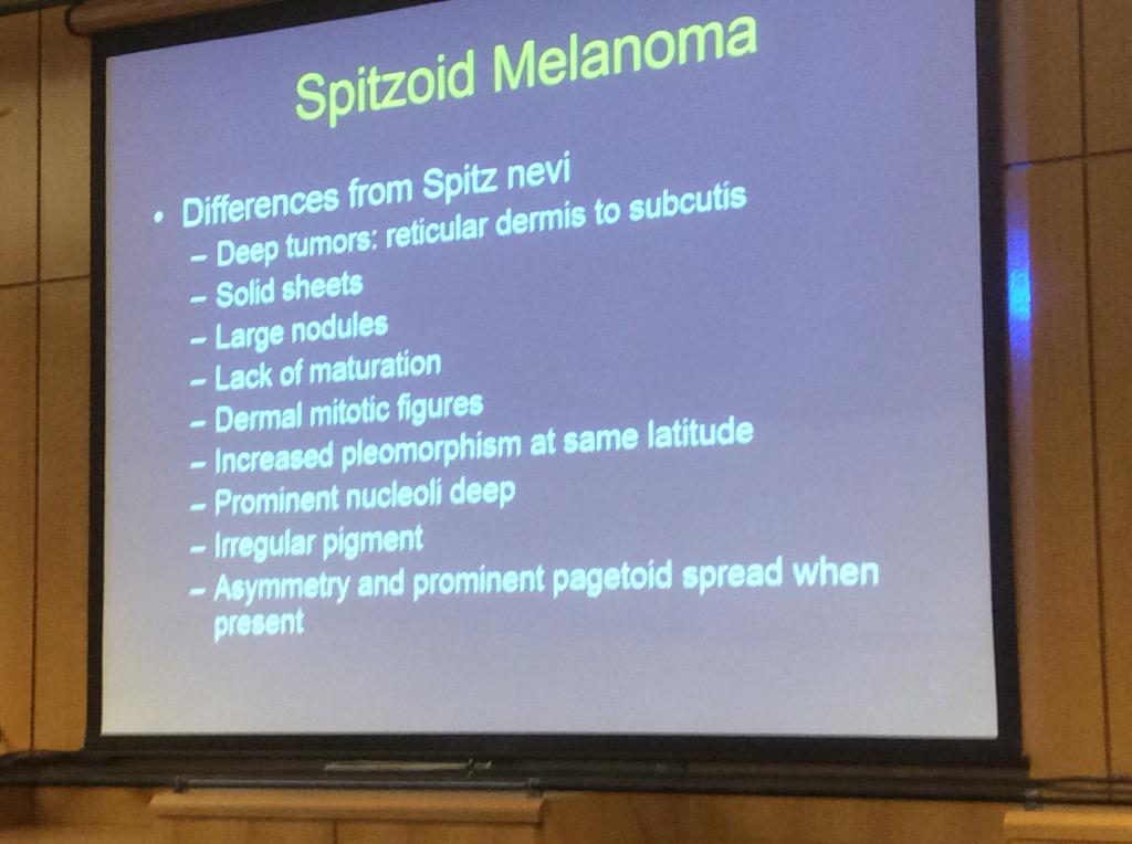 HassellLewis's tweet photo. Spitzoid #melanoma Challenging DDx, get help! look for prominent pagetoid spread #OSAP15 http://t.co/bmhCuqKUJH