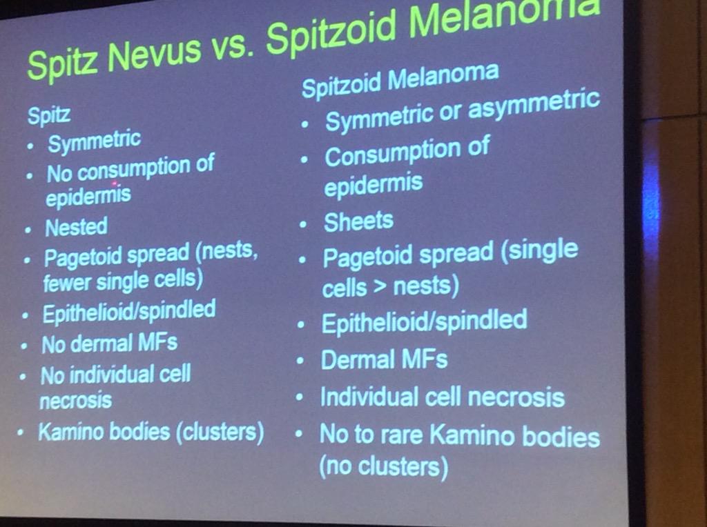HassellLewis's tweet photo. Spitzoid #melanoma Challenging DDx, get help! look for prominent pagetoid spread #OSAP15 http://t.co/bmhCuqKUJH