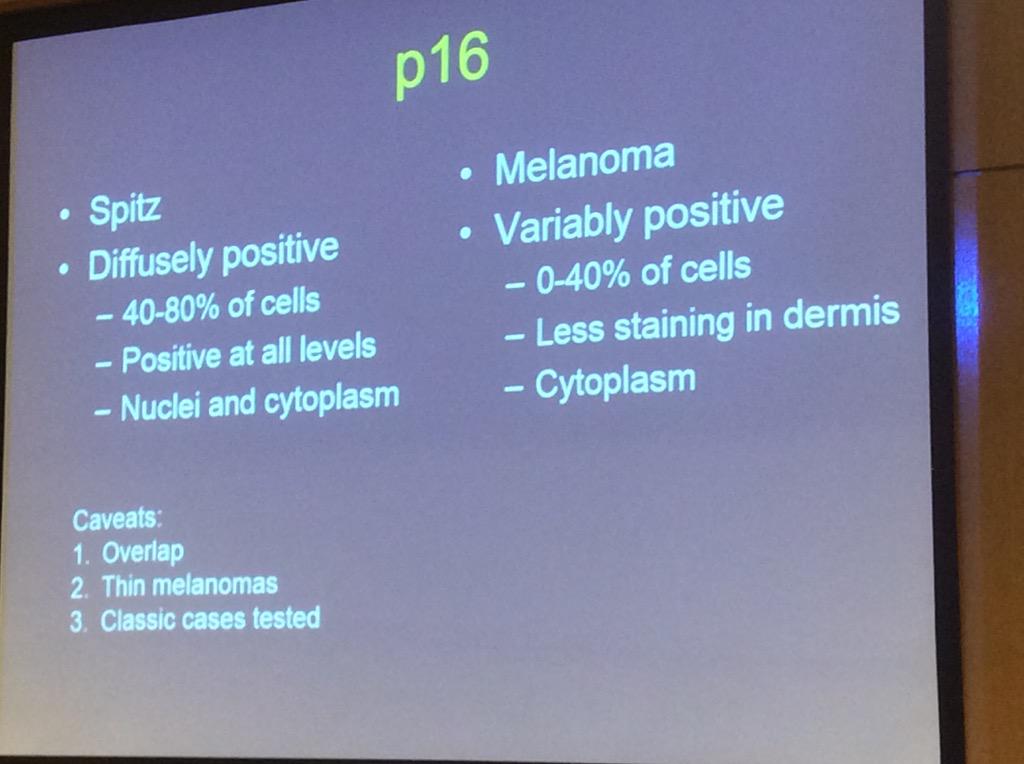 HassellLewis's tweet photo. Should you use p16 in challenging cases? Dr. Billings #OSAP15 #dermatopathology http://t.co/LxeQKN7b9S