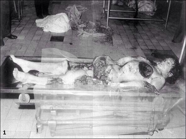 This man was a victim of cannibalism.