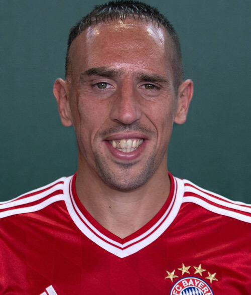 PurelyFootball's tweet photo. Ribery's scar on his face was a result of a car crash, in which he had to have 100 stitches in his face, aged 2. http://t.co/wrVhWN0CpM