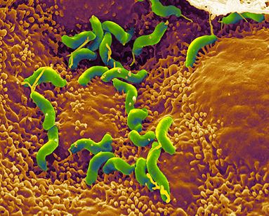 IlindelatorreMD's tweet photo. H. pylori. Bacterias coloreadas de verde y mucosa gastrica de ocre. Vía http://t.co/0KrpUw9ume. http://t.co/VlUHOs92A7