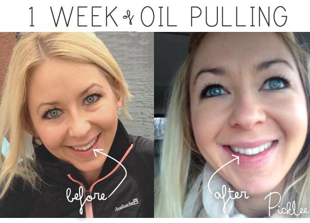 lenahuntco's tweet photo. #oilpulling kits cheaper than anywhere else! #whitening #crest #whitestrips Raw Coconut oil email lenahunt@live.com http://t.co/mcn4haJcc2
