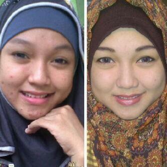 YukMaskerAlami's tweet photo. Masker Spirulina cocok untuk smua jenis kulit.Cewe/Cowo bisa pakai tnpa efek smping.pin:28550e0b sms/wa 081274366704 http://t.co/IdCe063Qnp
