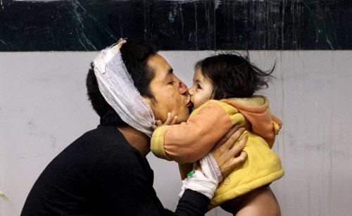timesofindia's tweet photo. Injured Nepalese man Suresh Parihar plays with his daughter Sandhya at a hospital, in Kathmandu,

#NepalEarthquake http://t.co/YUyNNbnJsz