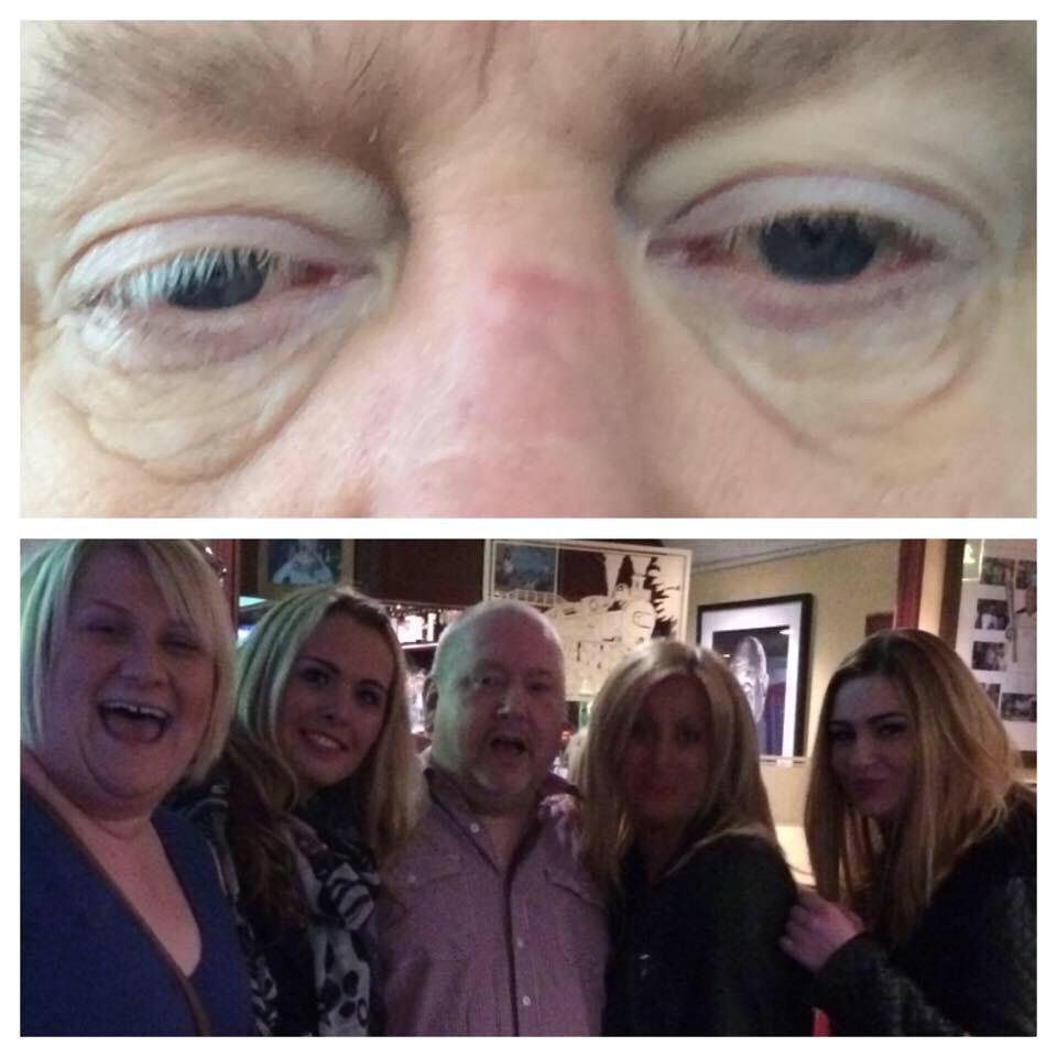 Bigdinger10's tweet photo. Here's my before and after photo using the Instantly Ageless. This stuff is amazing http://t.co/Z5dkFngI6w