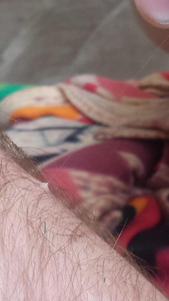 Shit_Cap_Says's tweet photo. Longest armhair of all time. I'm a freak of nature http://t.co/l1epczRmCh