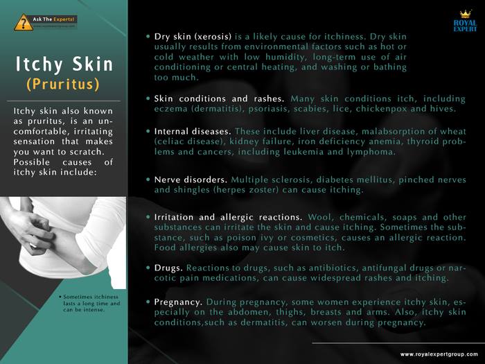 RoyalExpertGrp's tweet photo. The causes of #ItchySkin (#Pruritus).

https://t.co/cwRdsUjGAK
https://t.co/i7QEQ1Zh5e
http://t.co/Um0l3a1F1I http://t.co/lju6EierE0