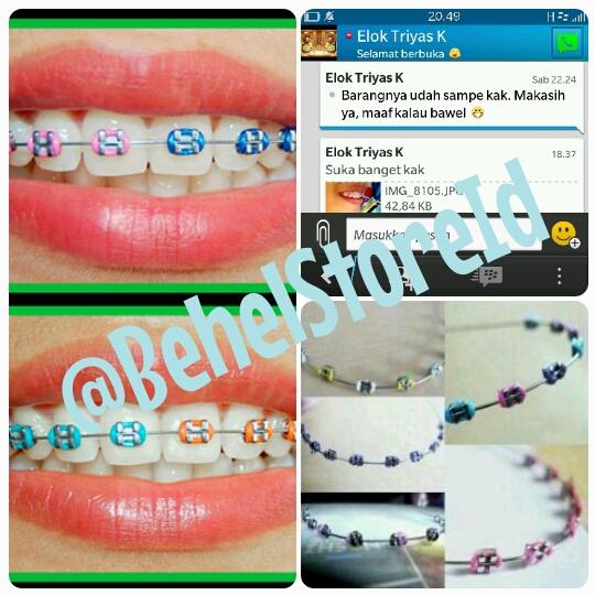 BehelStoreID's tweet image. Behel Lepas Pasang
TURUN HARGA
185 rb -&amp;gt; 125 rb aja 😊
FREEONGKIR
+ lengkap tinggal pakai😊
Seriusorder? pin 328498a7