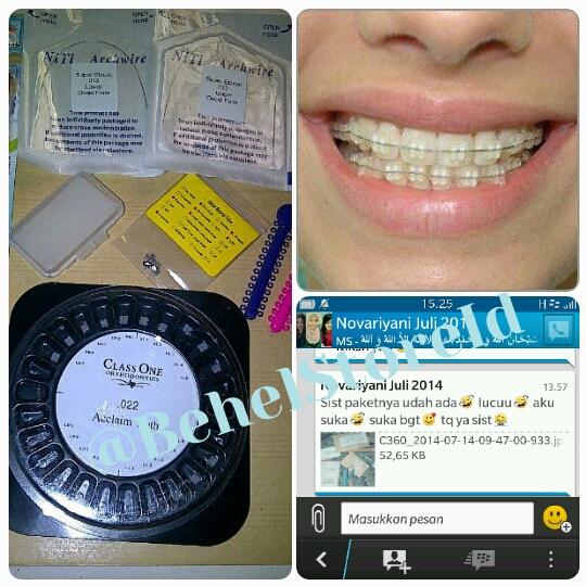 BehelStoreID's tweet image. Paket Permanen TRANSPARAN
Banting Harga
650 -&amp;gt; jadi 350 ribu aja😃
tgl psg ke dokter
mau?
FREEONGKIR😙
inv 328498a7