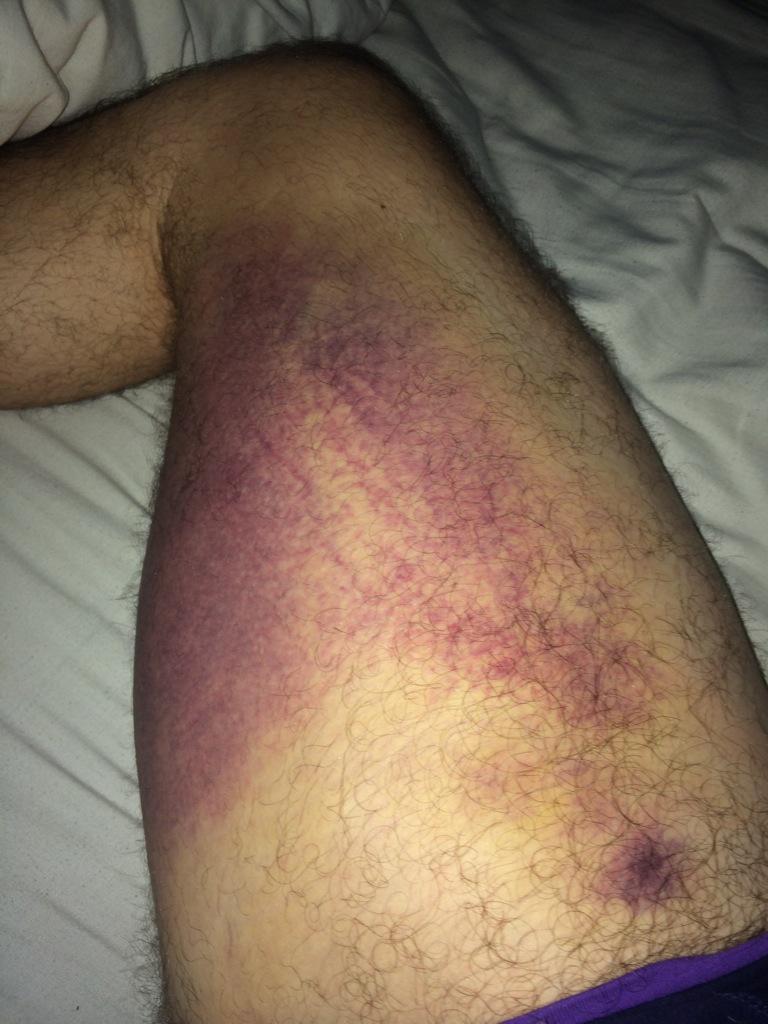 SheriffsGuy's tweet image. Monday morning trip to the doctors 👍👍🙈