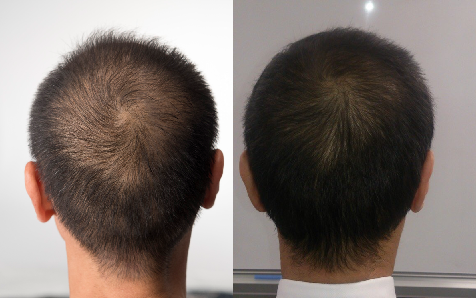 東国原英夫 最近 髪の毛が濃くなってきたと言われるんですけど どうですかね Http T Co Maivw1q46r Twitter