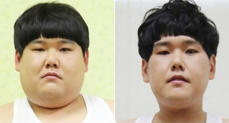 Soompi On Twitter Kim Soo Young Of Gag Concert Last Health Boy Loses 59kg 130lb In 12 Weeks Http T Co Emrrykswfj Http T Co Haurkdsirf Twitter