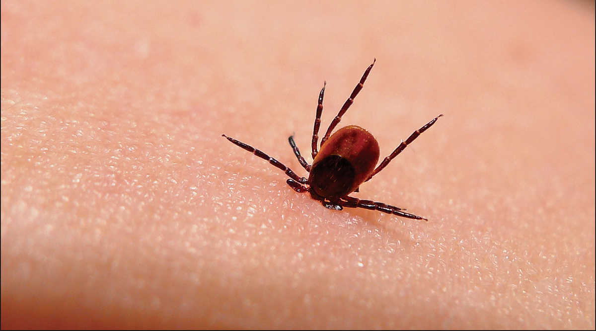 Ahmadgill789's tweet photo. Tick on human skin! http://t.co/SYsgZSHAJk