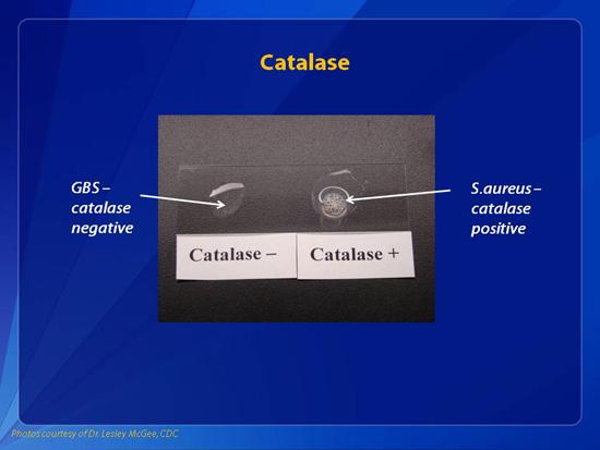 NGHCatalase's tweet photo. Catalase fights hydrogen peroxide damage. #catalaseendsgray http://t.co/qoOB92IvGo http://t.co/iH2ZB9gf85