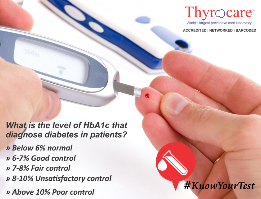 Thyrocare's tweet photo. #KnowYourTest What is the level of HbA1c that diagnose diabetes in patients? http://t.co/T1LtLcDwP2