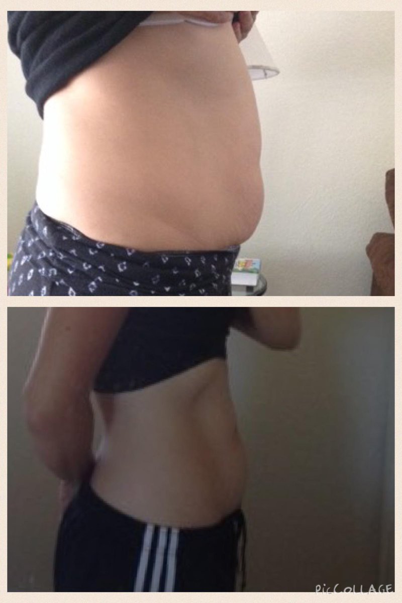 TheLesleyShow's tweet image. I&apos;m on the last week of my #CoreTransformation! #HealthySelfie writedge.com/lose-weight-a-… #LosingWeight #FeelingAwesome