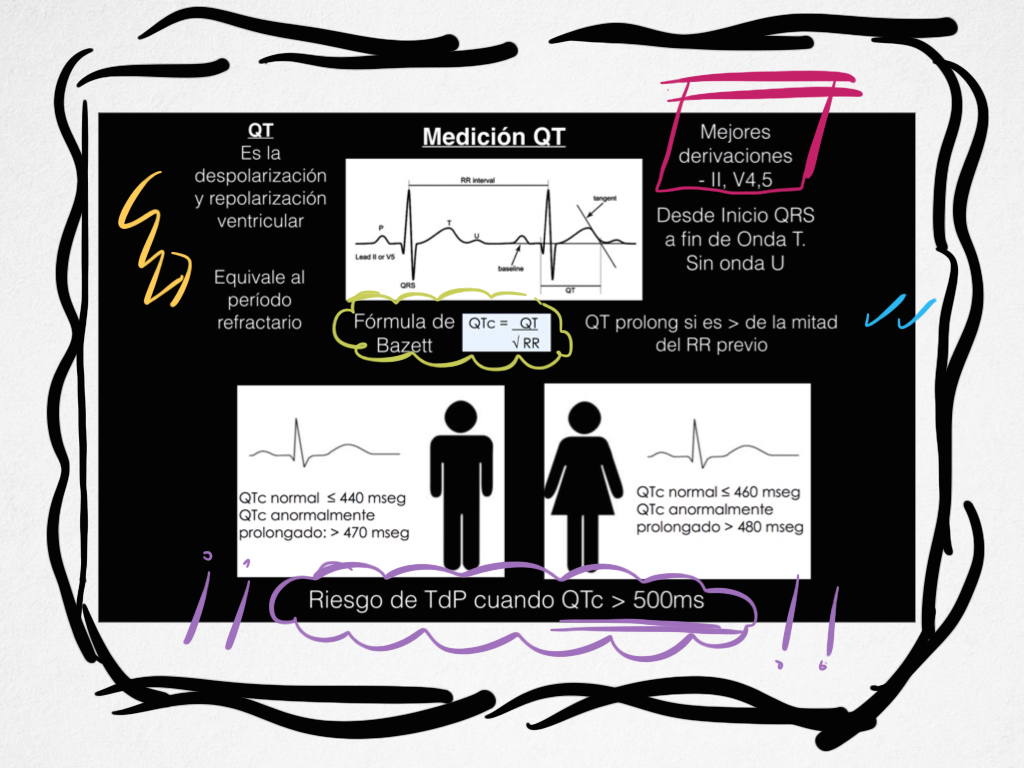 Ed_Alania's tweet photo. Medición del Intervalo QT ... #cardiologia #cardiotips #ecgtips #FOAMed http://t.co/c1OQOGoWmT
