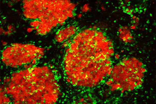 cellider's tweet image. #Stemcells therapy promising for #cancer #metastasis @harvardstemcell @MassGeneralNews goo.gl/F4JW7m