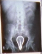 PatrickJCoffin's tweet photo. Looks like someone's colon had an idea http://t.co/oPlVpJ22bh