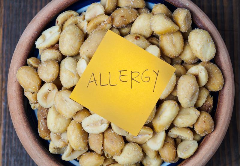 HarvardHealth's tweet image. Study says kids who eat #peanuts at an early age may prevent developing peanut allergies: hvrd.me/Mfj2F