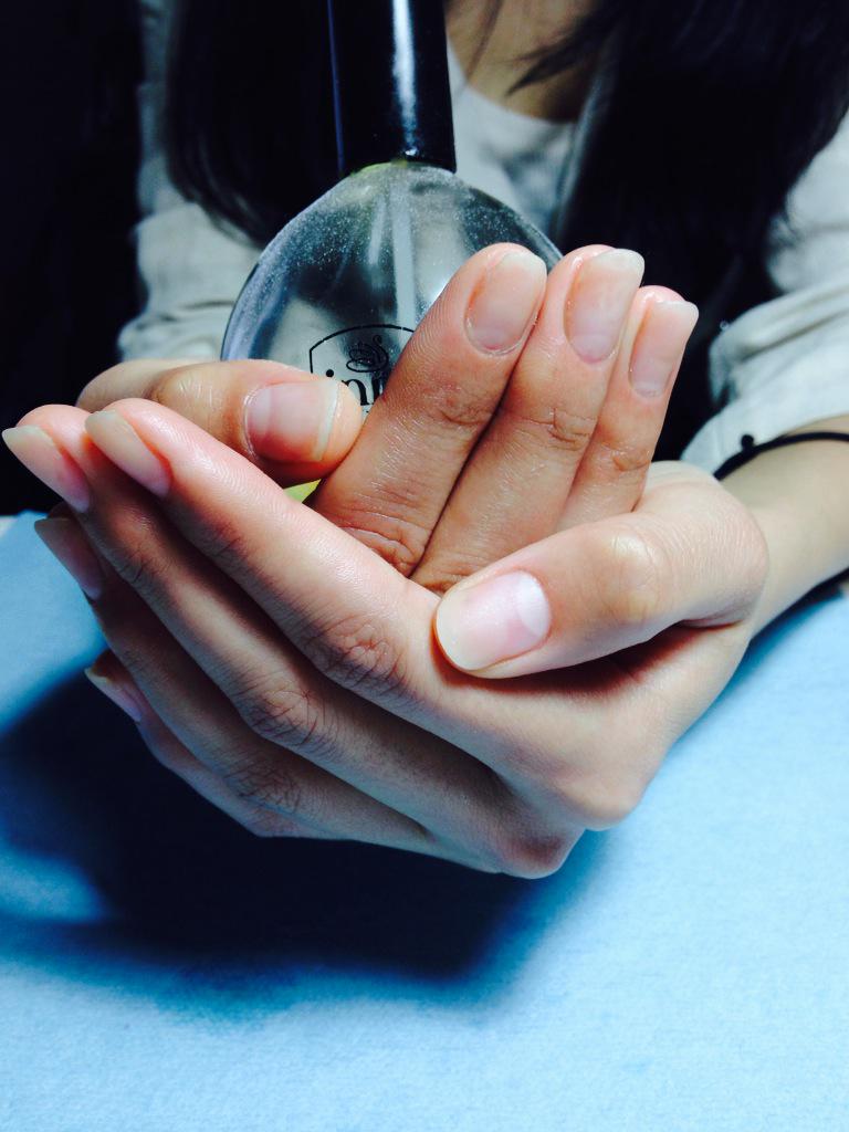 相作 桃香 お客様の爪 約2ヶ月ぶり ボロボロになってましたが綺麗になりました 深爪 爪が綺麗に 爪をむしる 深爪 Http T Co Cu7syk32ig