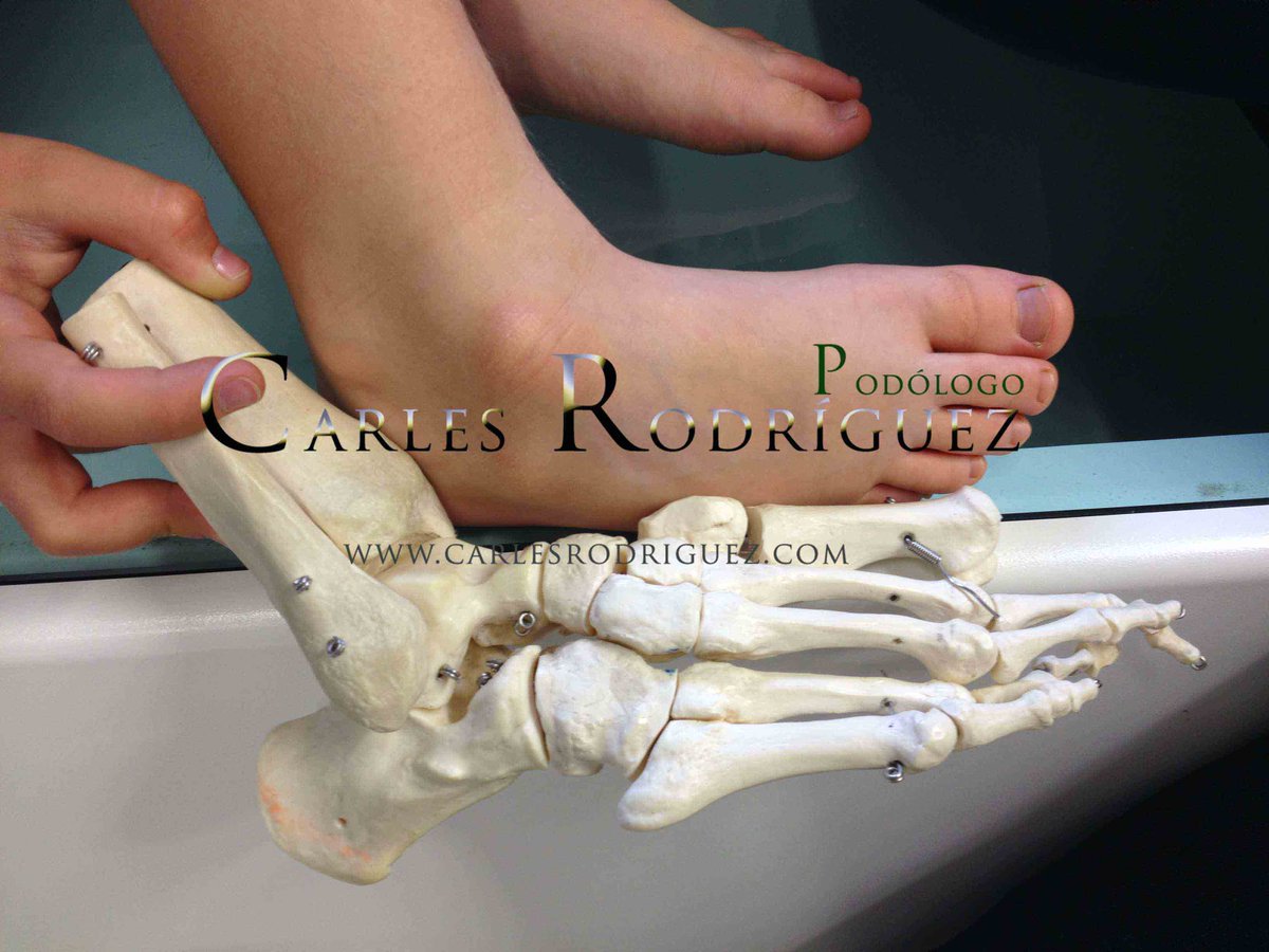 carlesrdguez's tweet photo. #podologiainfantil las #laxitudes pueden producir modificaciones estructurales en carga q afecten el buen desarrollo. http://t.co/vLXgjqKmrU