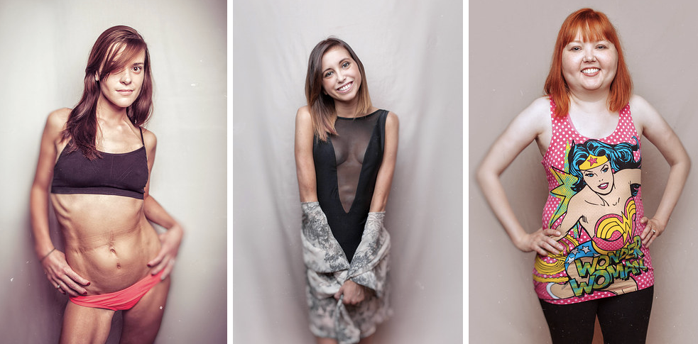 BuzzFeed's tweet photo. This photographer started a photo project to show that women w. cystic fibrosis are beautiful http://t.co/VdXPiHfsKP http://t.co/0sCmiWrNku