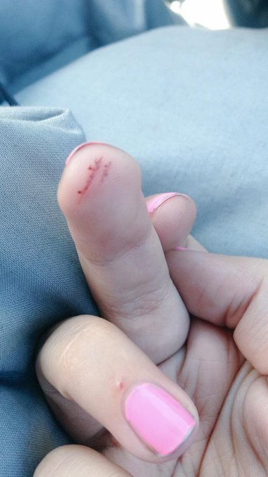 LOOK AT MY PAPERCUT. How am I gonna fap with dis ;~~~; http://t.co/rDuaWN7uNg<a href="/tag/assworship"class="tags"><span>#assworship</span></a><a href="/tag/findom"class="tags"><span>#findom</span></a><a href="/tag/paypigswanted"class="tags"><span>#paypigswanted</span></a>