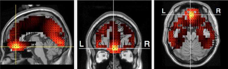 MUMediaBrainLab's tweet image. The neuroscience of consumer choice: phys.org/news/2015-04-n…