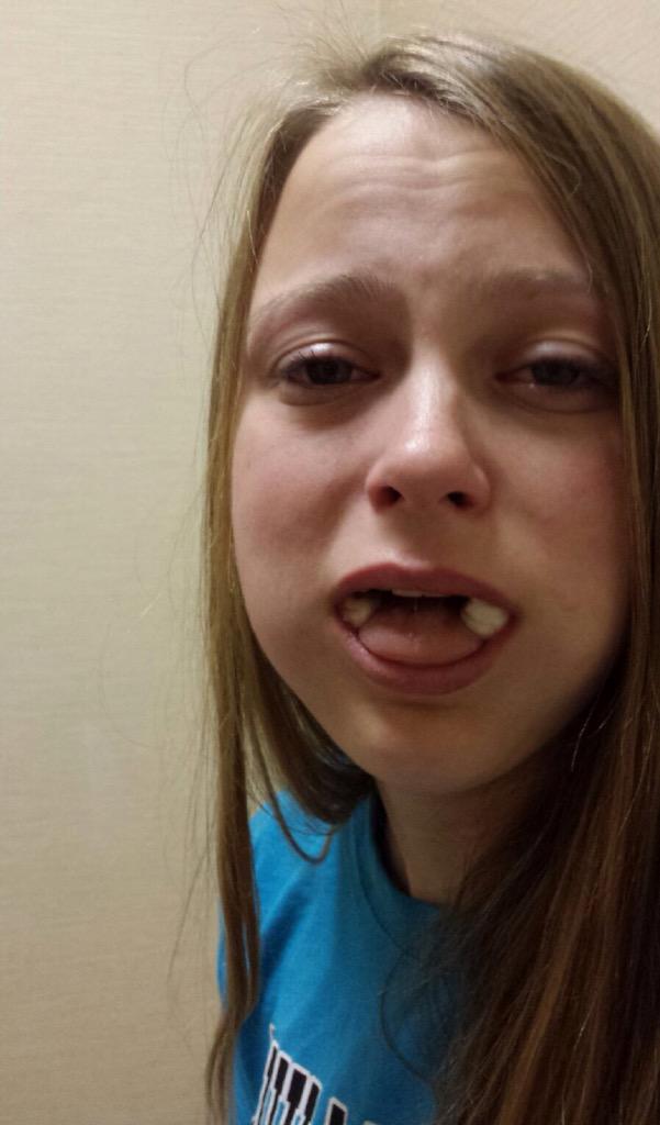megankosar's tweet photo. *crying* "mom are you sure they didn't cut off my tongue?" #lostsomewisdom http://t.co/PWOpSacXdG