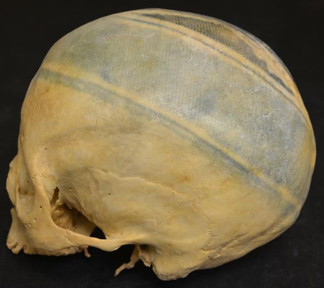 Forbes's tweet photo. Can you tattoo a bone? http://t.co/pDIigs0V6m http://t.co/bNt0cidN6z