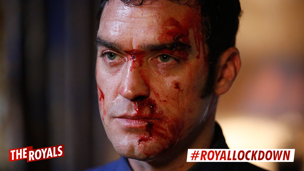 DThroneScandal's tweet photo. Who the hell beat the cyrous out of him #TheRoyalsFinale Sunday night. #RoyalLockdown http://t.co/1grQokaMBf"