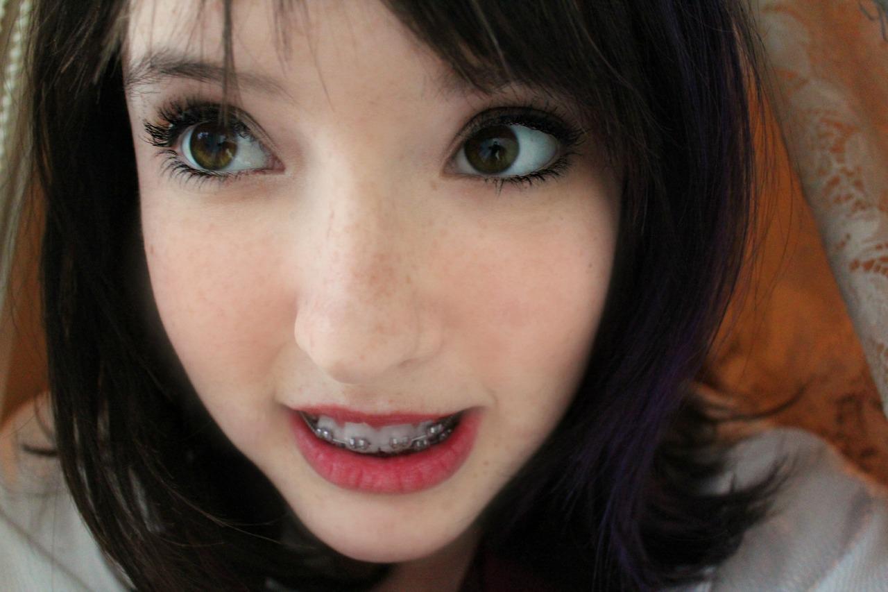 Girls With Braces on Twitter "Keep On Smiling braces http//t.co