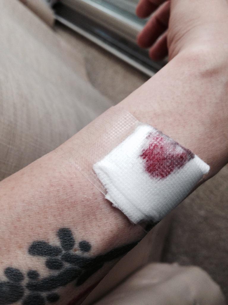 michi's tweet photo. No appendix bursting today. Looks like my arm was just on the rag. Lol. #grodes http://t.co/KKCjuBYaX4