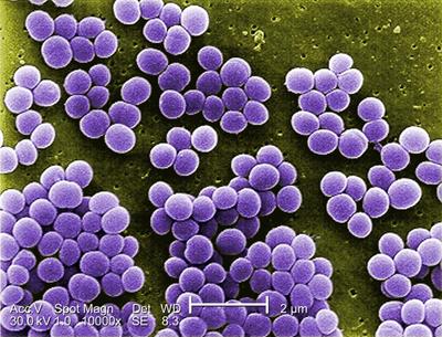 _brittanywalter's tweet photo. This is gram negative coccus bacteria because it is purple. The morphology is sphere. http://t.co/A0qLjobMBC